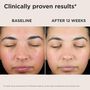 EltaMD UV Skin Recovery Broad Spectrum SPF 50 Face Sunscreen, , large image number 4