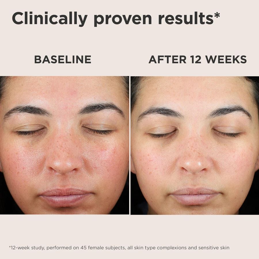 EltaMD UV Skin Recovery Broad Spectrum SPF 50 Face Sunscreen, , large image number 4