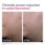 EltaMD UV Clear Blemish-Prone & Oil Balancing, SPF 50, 1.7 oz., , large image number 6