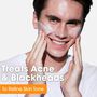 AcneFree Blackhead Removing Scrub with Charcoal, 5 oz., , large image number 1